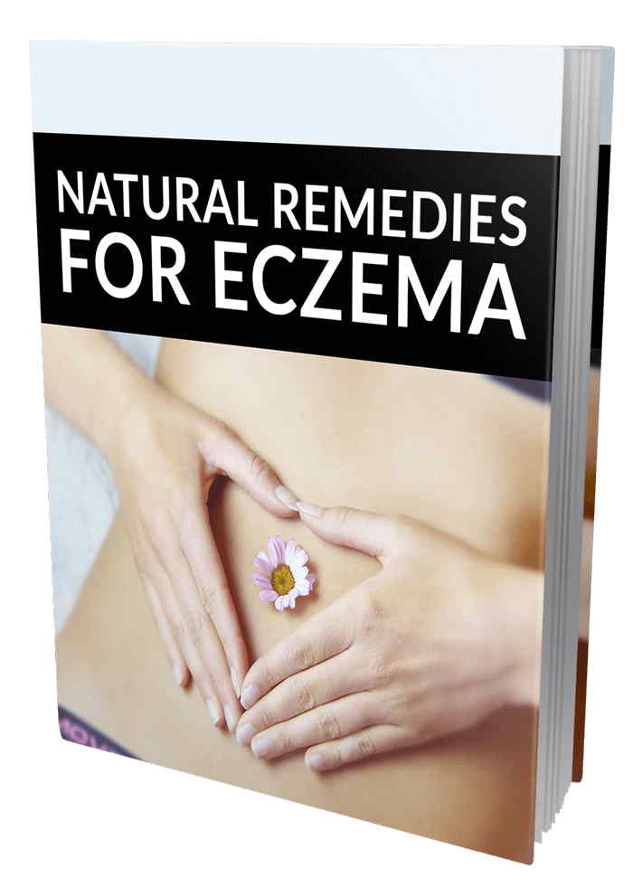 Natural Remedies For Eczema