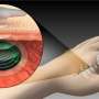 charge-batteries-through-skin-with-permanent-implantable-device-concept