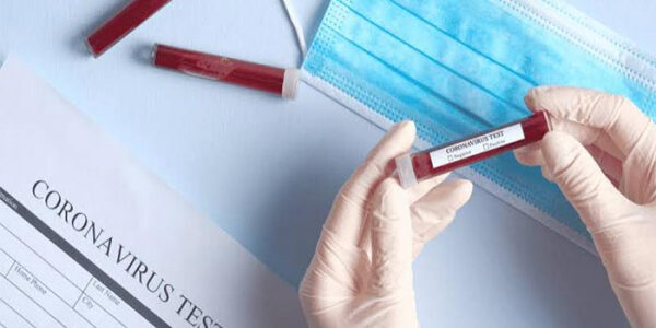 just-in:-coronavirus-cases-hit-30-in-nigeria-as-lagos-confirms-three-more-infections just-in:-coronavirus-cases-hit-30-in-nigeria-as-lagos-confirms-three-more-infections