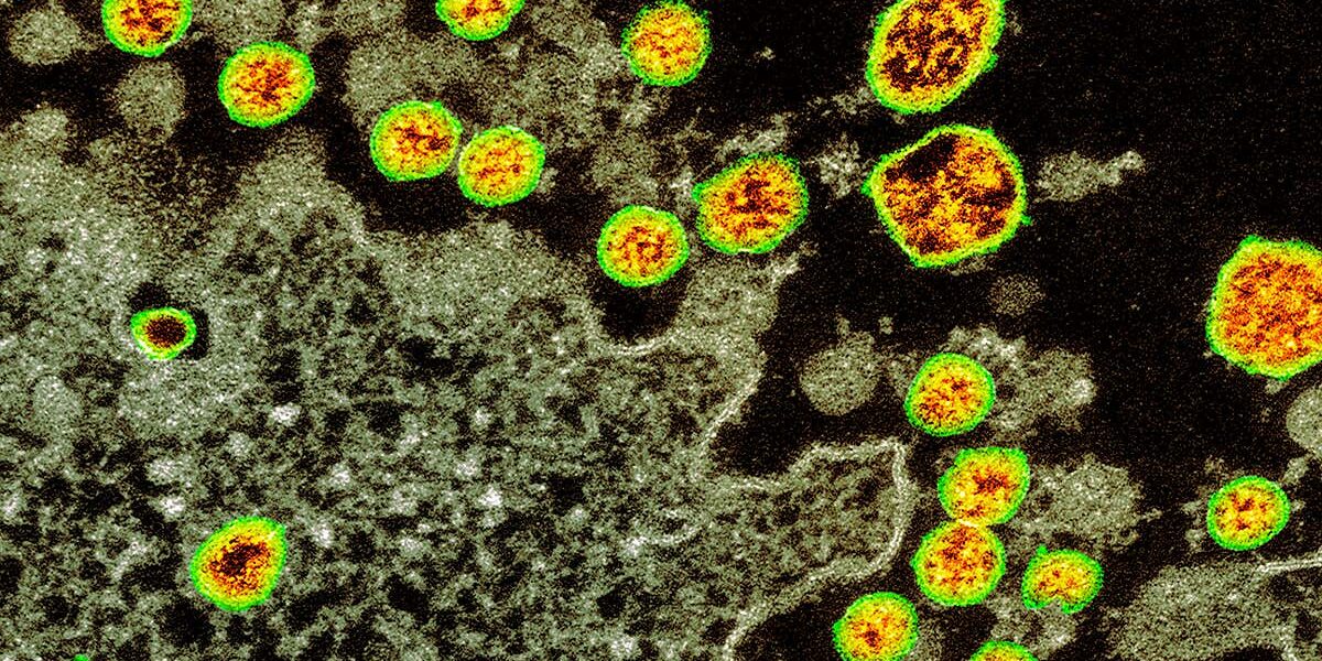 can-you-catch-the-coronavirus-twice?-we-don’t-know-yet can-you-catch-the-coronavirus-twice?-we-don’t-know-yet