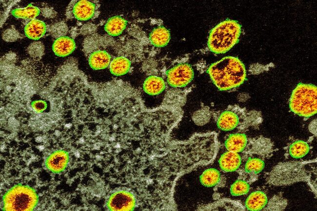 can-you-catch-the-coronavirus-twice?-we-don’t-know-yet can-you-catch-the-coronavirus-twice?-we-don’t-know-yet