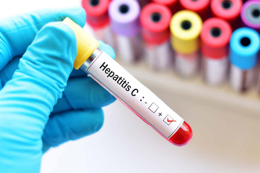 hepatitis-c-infection-rates-are-being-cut-by-testing-and-treatment