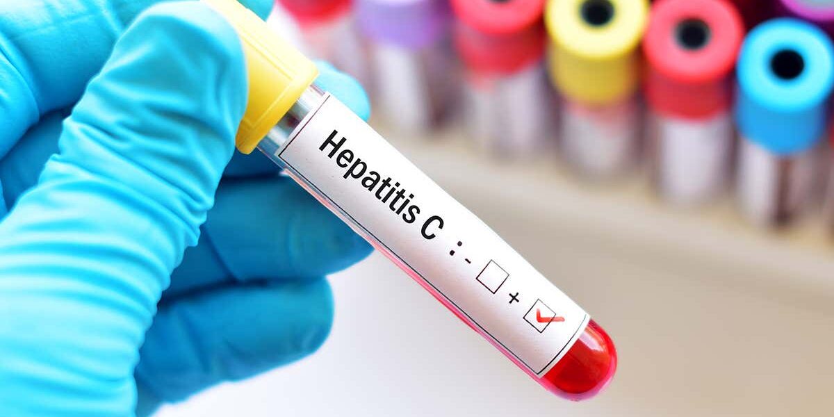 hepatitis-c-infection-rates-are-being-cut-by-testing-and-treatment hepatitis-c-infection-rates-are-being-cut-by-testing-and-treatment