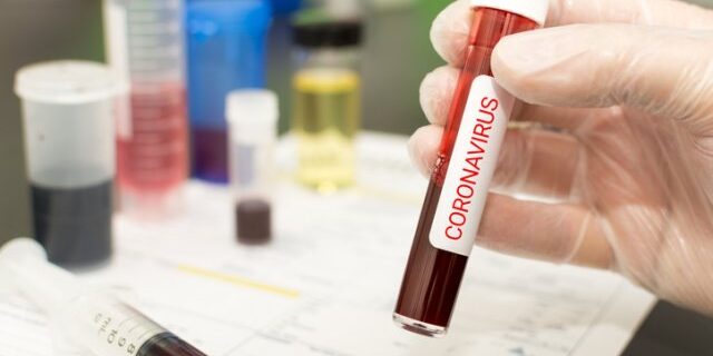 breaking:-benue-state-confirms-first-case-of-coronavirus breaking:-benue-state-confirms-first-case-of-coronavirus