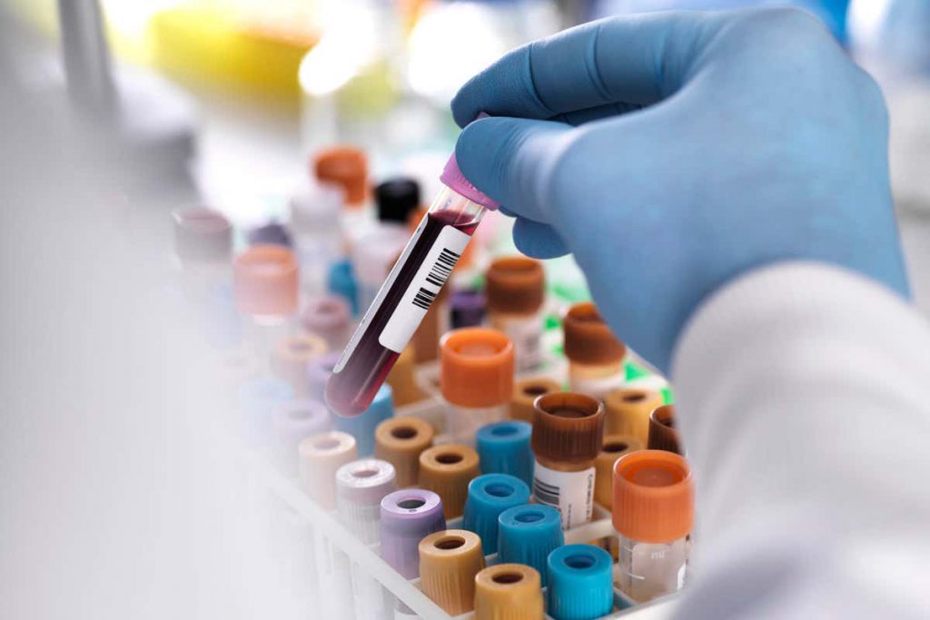 blood-test-shows-promise-for-detecting-the-deadliest-cancers-early