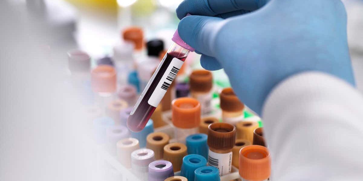 blood-test-shows-promise-for-detecting-the-deadliest-cancers-early blood-test-shows-promise-for-detecting-the-deadliest-cancers-early