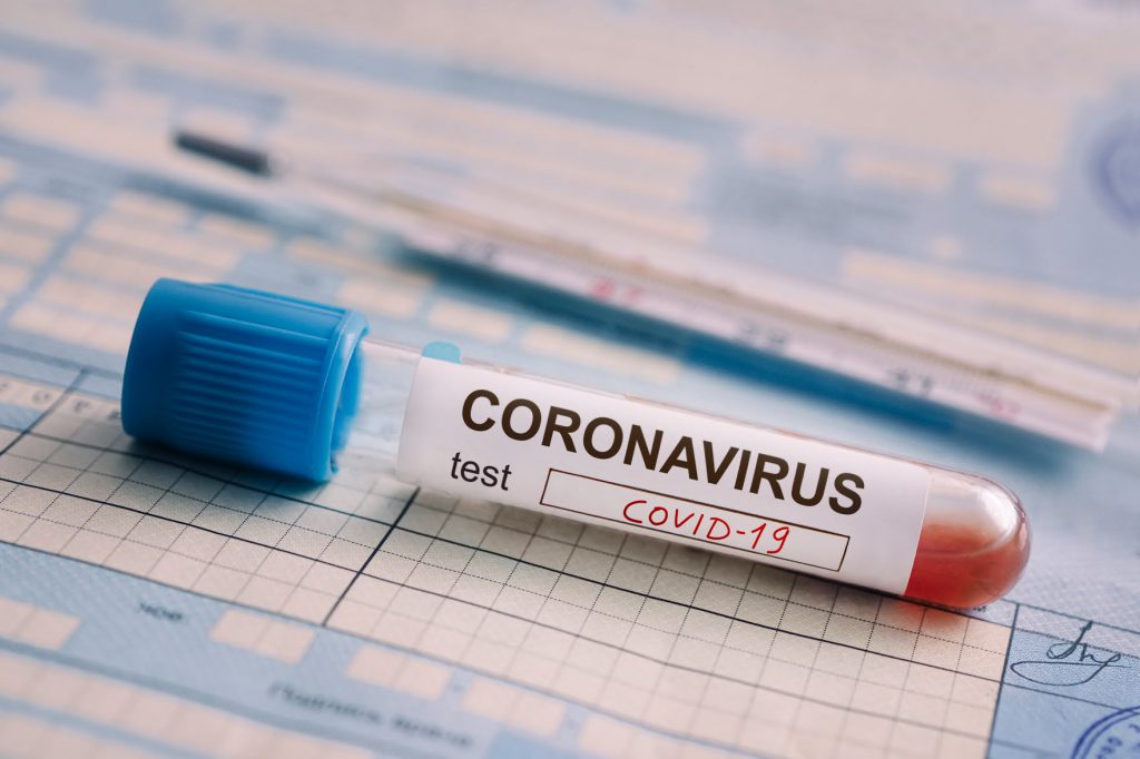breaking:-ncdc-confirms-10-new-coronavirus-cases-in-nigeria