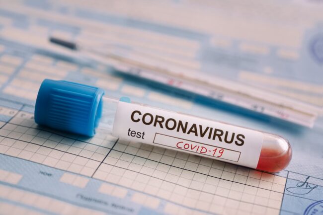 breaking:-ncdc-confirms-10-new-coronavirus-cases-in-nigeria breaking:-ncdc-confirms-10-new-coronavirus-cases-in-nigeria