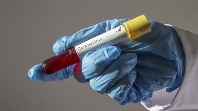 nigeria’s-coronavirus-cases-rise-to-131 nigeria’s-coronavirus-cases-rise-to-131