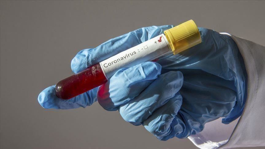 nigeria’s-coronavirus-cases-rise-to-131