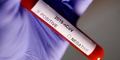 ppuitm-aims-to-increase-covid-19-detection-test-to-200-samples-daily-from-tomorrow ppuitm-aims-to-increase-covid-19-detection-test-to-200-samples-daily-from-tomorrow