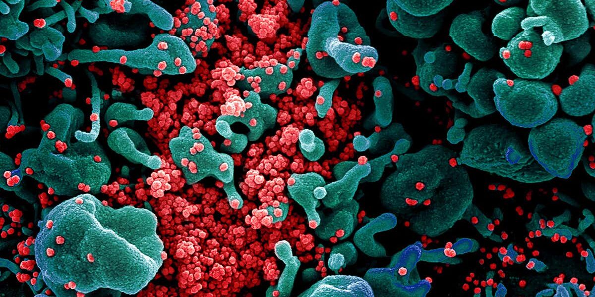 does-the-ace2-protein-explain-covid-19-risk-for-underlying-conditions? does-the-ace2-protein-explain-covid-19-risk-for-underlying-conditions?