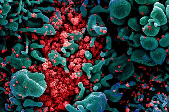 does-the-ace2-protein-explain-covid-19-risk-for-underlying-conditions? does-the-ace2-protein-explain-covid-19-risk-for-underlying-conditions?