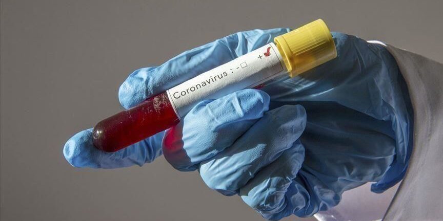 five-nigerians-in-china-test-positive-for-coronavirus five-nigerians-in-china-test-positive-for-coronavirus